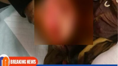 Ngeri, Dua Warga Bangkalan Dibacok Orang Tak Dikenal